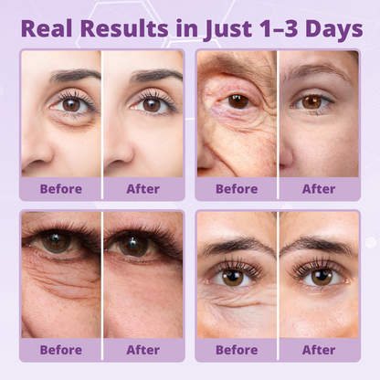 🌸 Perfection Thamos Rauth – New Formula, Ultimate Lift & Smooth Finish ✨